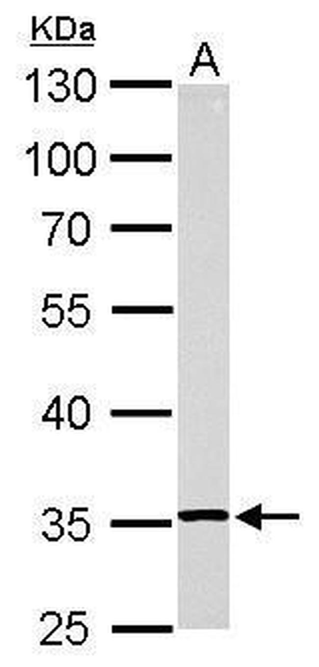 RPL5 Antibody in Western Blot (WB)