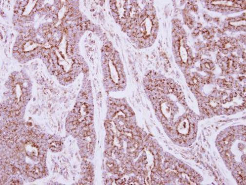 NDUFS5 Antibody in Immunohistochemistry (Paraffin) (IHC (P))