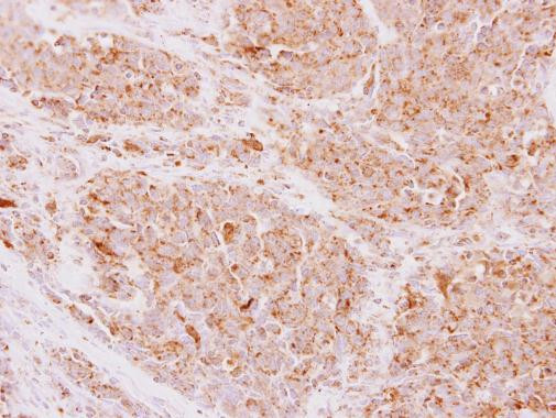 NDUFS5 Antibody in Immunohistochemistry (Paraffin) (IHC (P))