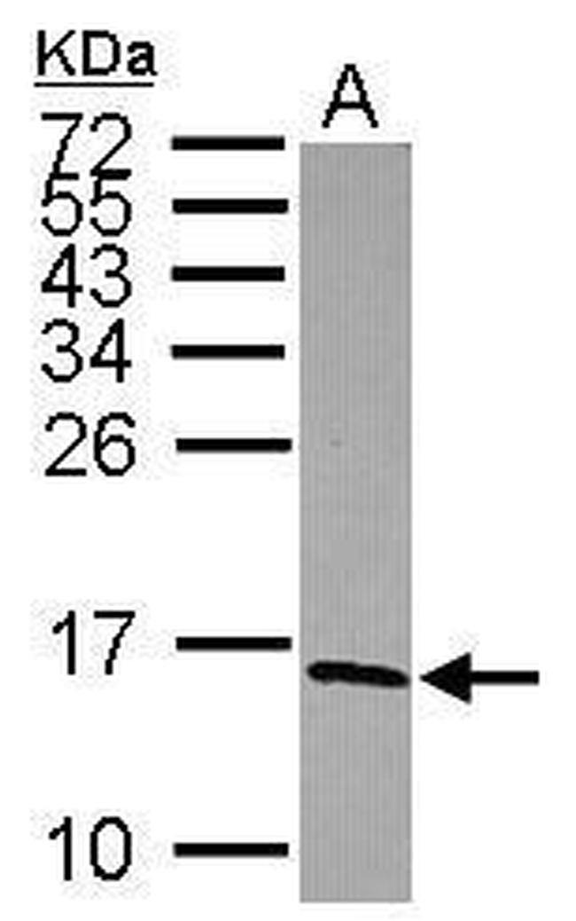 NDUFS5 Antibody in Western Blot (WB)