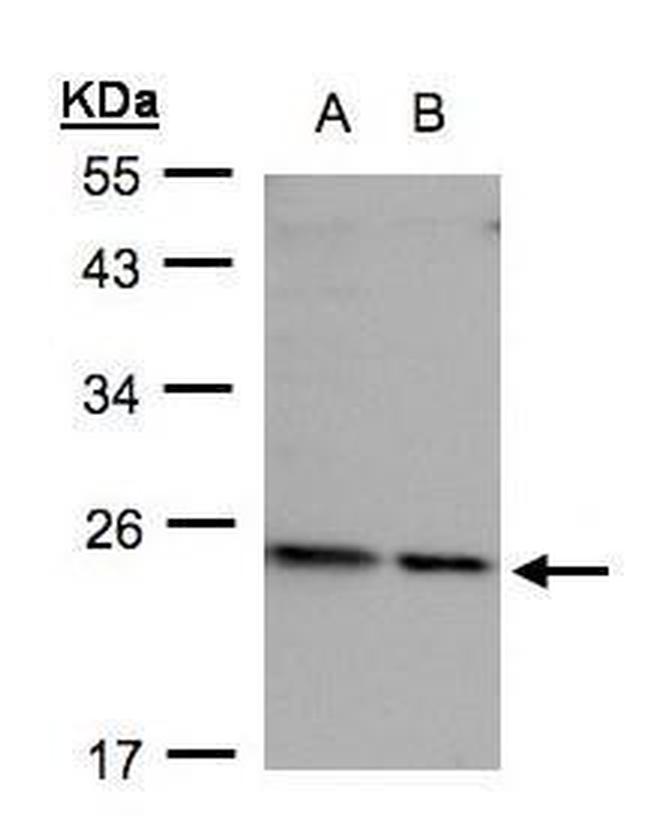 RPL17 Antibody in Western Blot (WB)