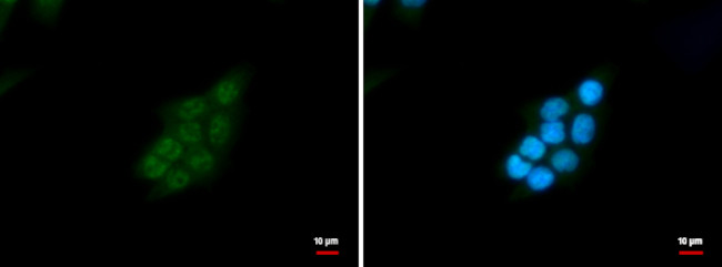 SNRPD2 Antibody in Immunocytochemistry (ICC/IF)