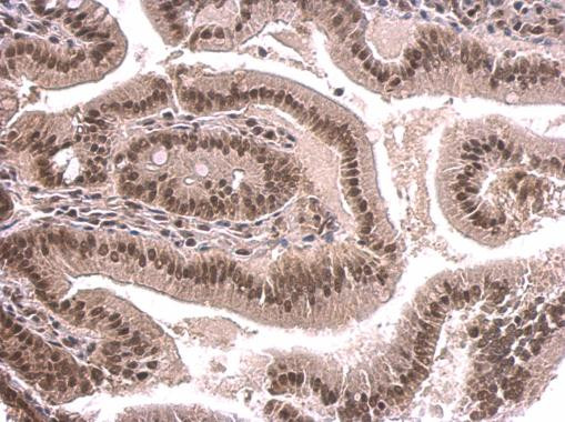 SNRPD2 Antibody in Immunohistochemistry (Paraffin) (IHC (P))