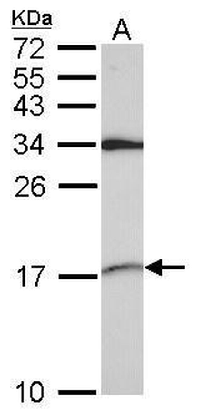 SNRPD2 Antibody in Western Blot (WB)