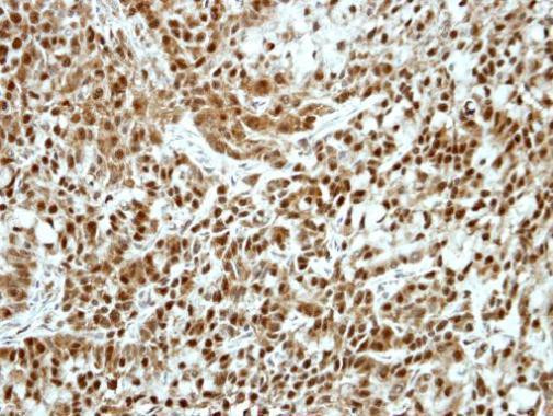 Ku70 Antibody in Immunohistochemistry (Paraffin) (IHC (P))