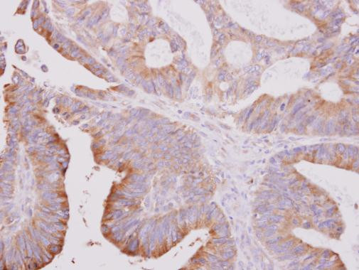 beta Tubulin 2 Antibody in Immunohistochemistry (Paraffin) (IHC (P))