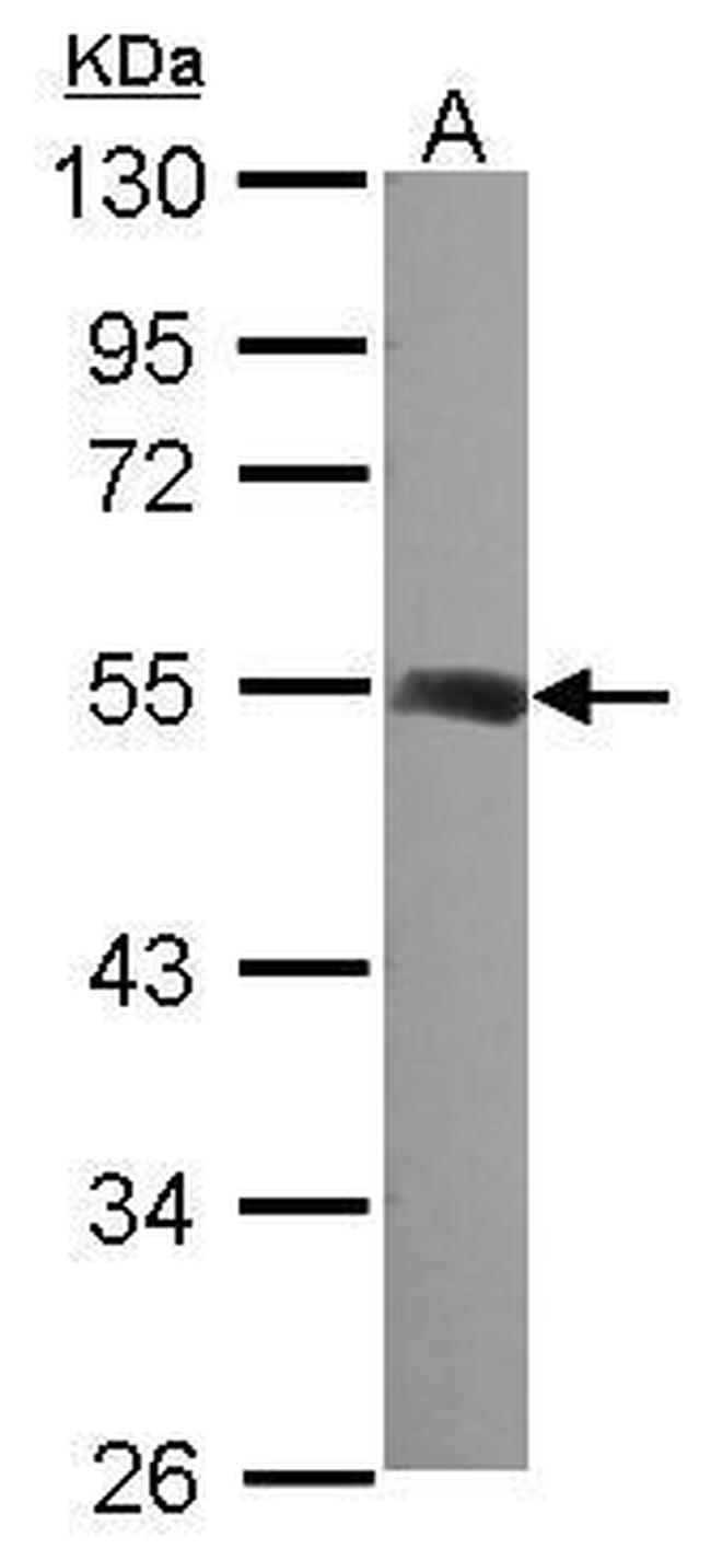 beta Tubulin 2 Antibody in Western Blot (WB)