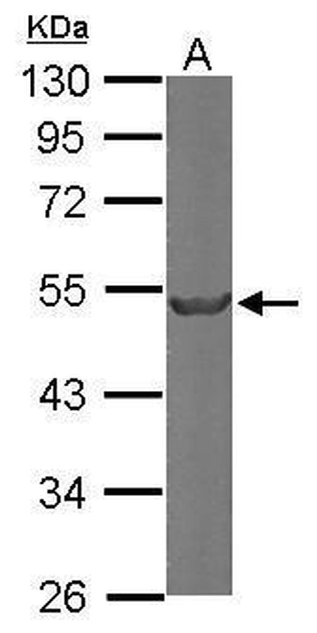 beta Tubulin 2 Antibody in Western Blot (WB)