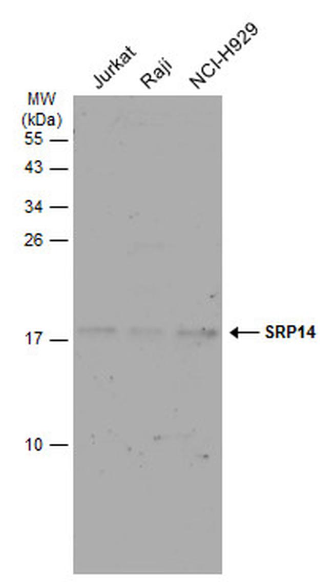 SRP14 Antibody in Western Blot (WB)