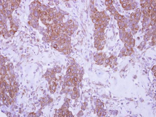 CD79b Antibody in Immunohistochemistry (Paraffin) (IHC (P))