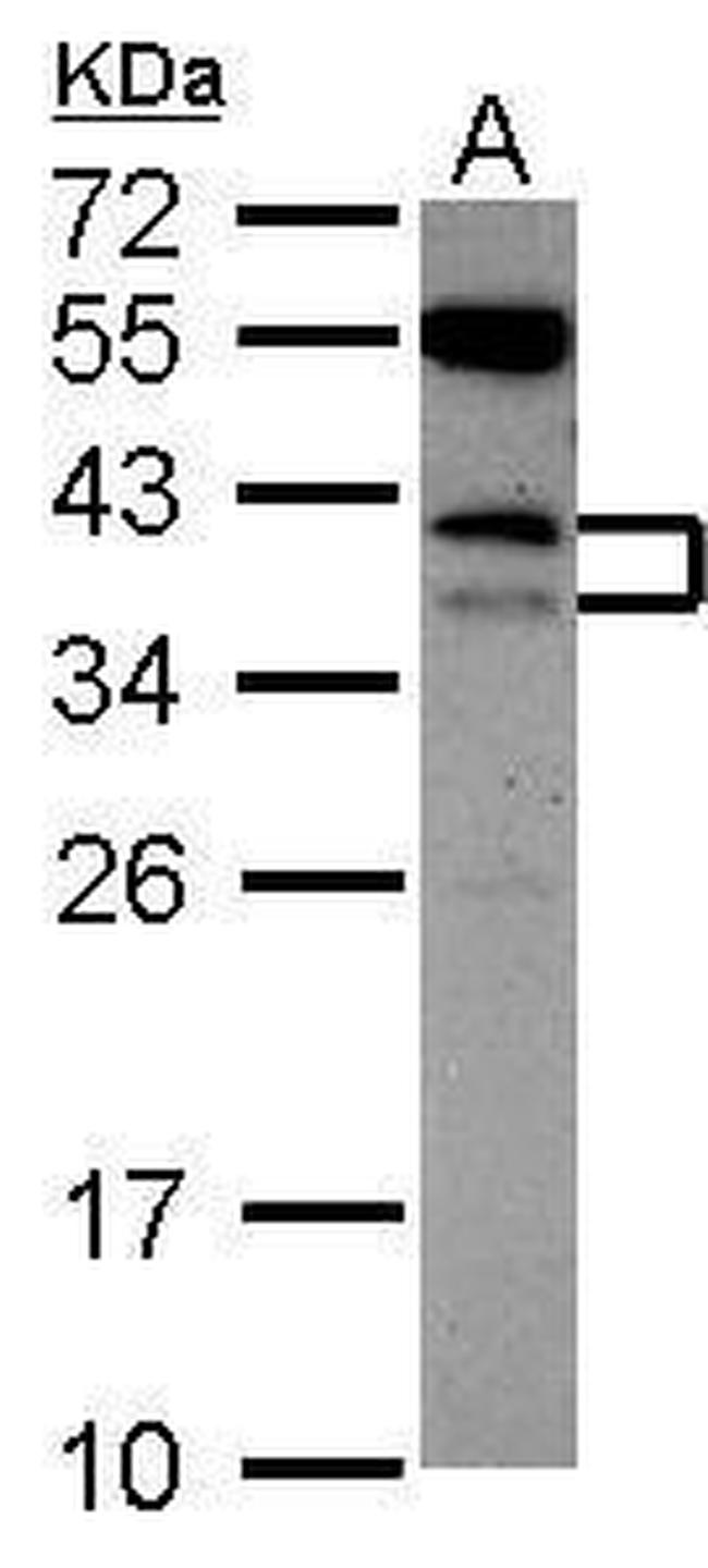 CD79b Antibody in Western Blot (WB)