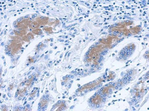 Annexin A2 Antibody in Immunohistochemistry (Paraffin) (IHC (P))