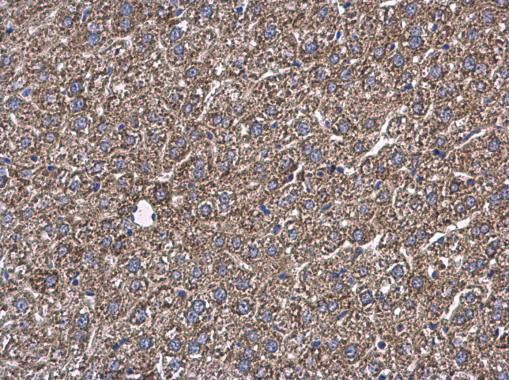 GOT2 Antibody in Immunohistochemistry (Paraffin) (IHC (P))