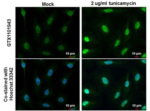 ATF4 Antibody in Immunocytochemistry (ICC/IF)