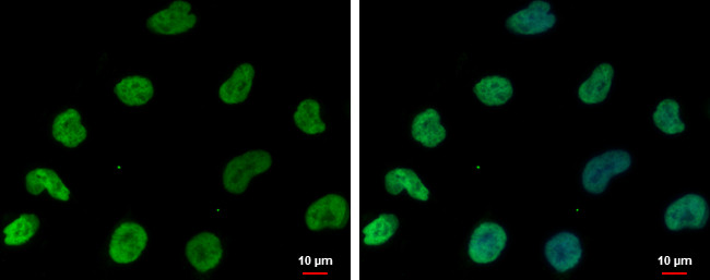 DNAJB6 Antibody in Immunocytochemistry (ICC/IF)