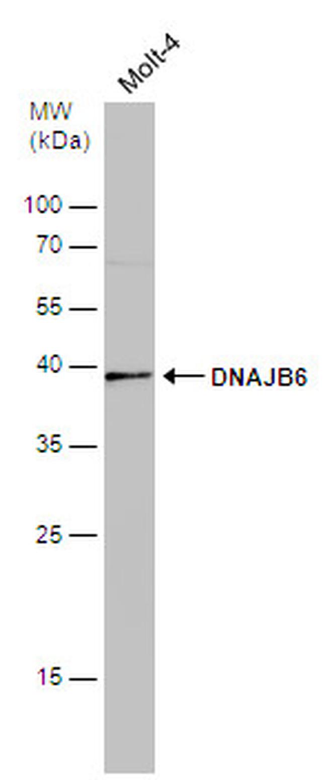 DNAJB6 Antibody in Western Blot (WB)