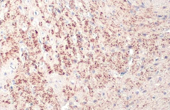 TPH2 Antibody in Immunohistochemistry (Paraffin) (IHC (P))