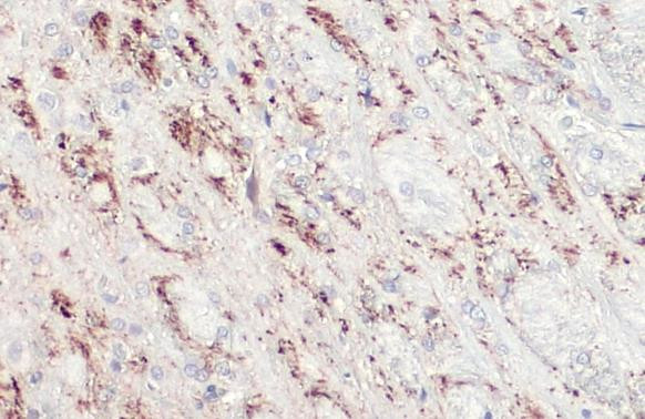 TPH2 Antibody in Immunohistochemistry (Paraffin) (IHC (P))