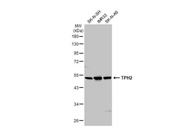 TPH2 Antibody in Western Blot (WB)