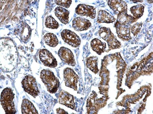 eIF3f Antibody in Immunohistochemistry (Paraffin) (IHC (P))