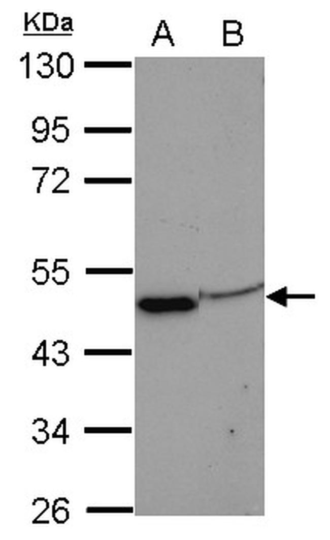 eIF3f Antibody in Western Blot (WB)