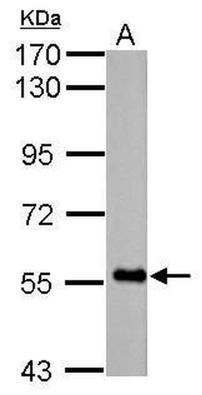 FBXO7 Antibody in Western Blot (WB)