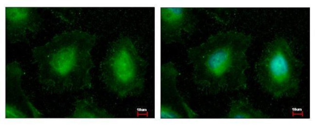 eIF3k Antibody in Immunocytochemistry (ICC/IF)