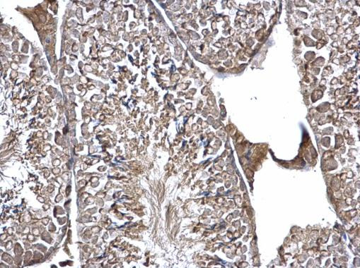 eIF3k Antibody in Immunohistochemistry (Paraffin) (IHC (P))