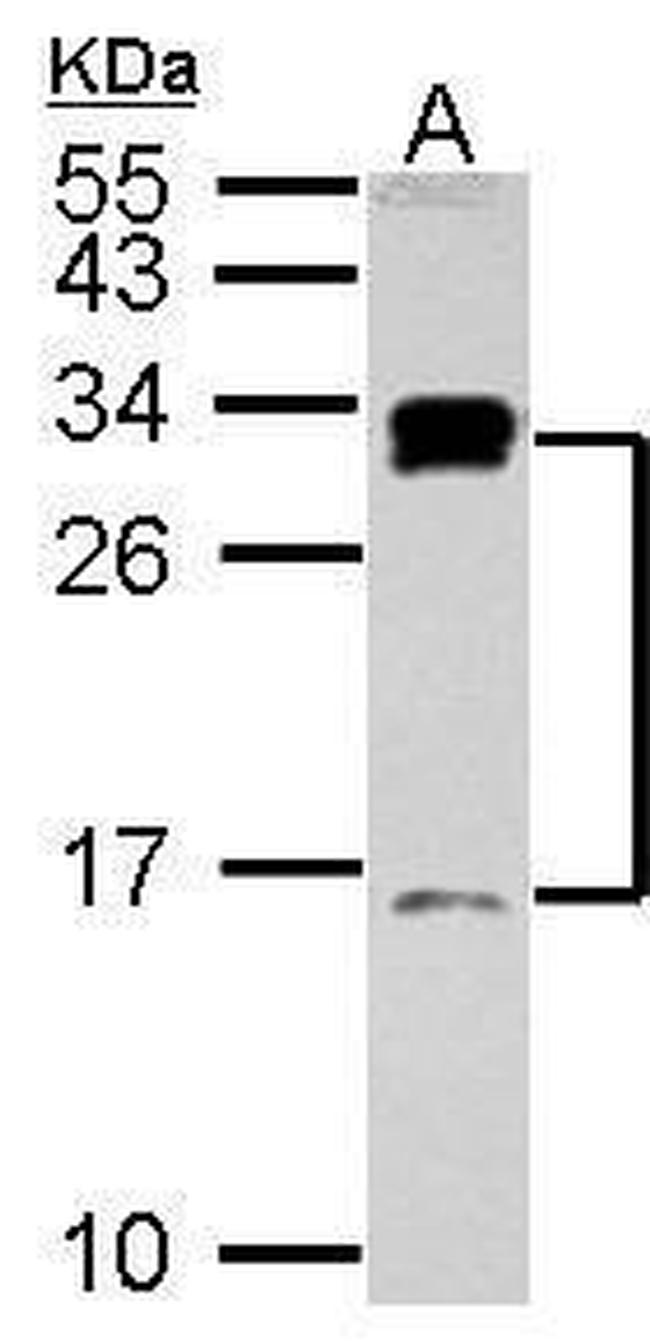 C1D Antibody in Western Blot (WB)