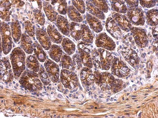 TRAP1 Antibody in Immunohistochemistry (Paraffin) (IHC (P))