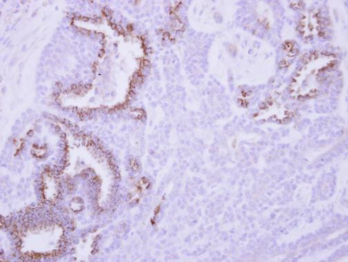 MCL-1 Antibody in Immunohistochemistry (Paraffin) (IHC (P))