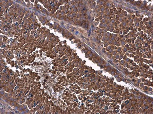 MCL-1 Antibody in Immunohistochemistry (Paraffin) (IHC (P))