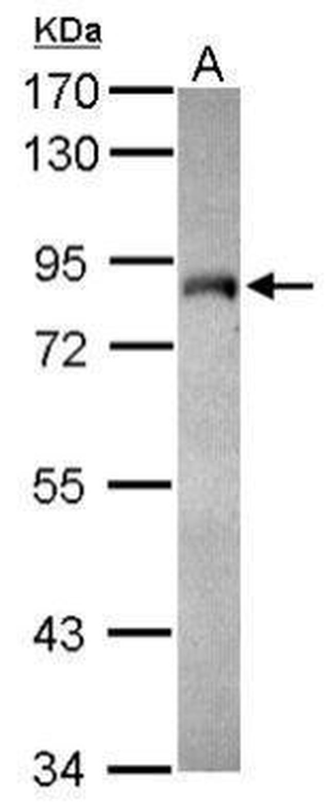 MYST2 Antibody in Western Blot (WB)