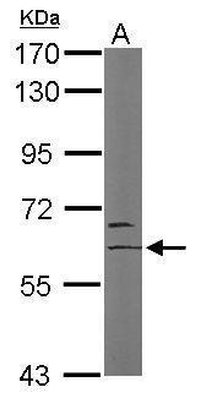 MYST2 Antibody in Western Blot (WB)