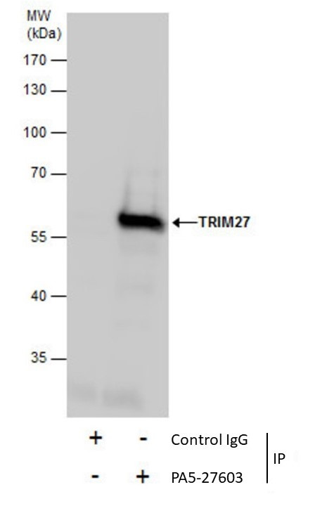 TRIM27 Antibody in Immunoprecipitation (IP)