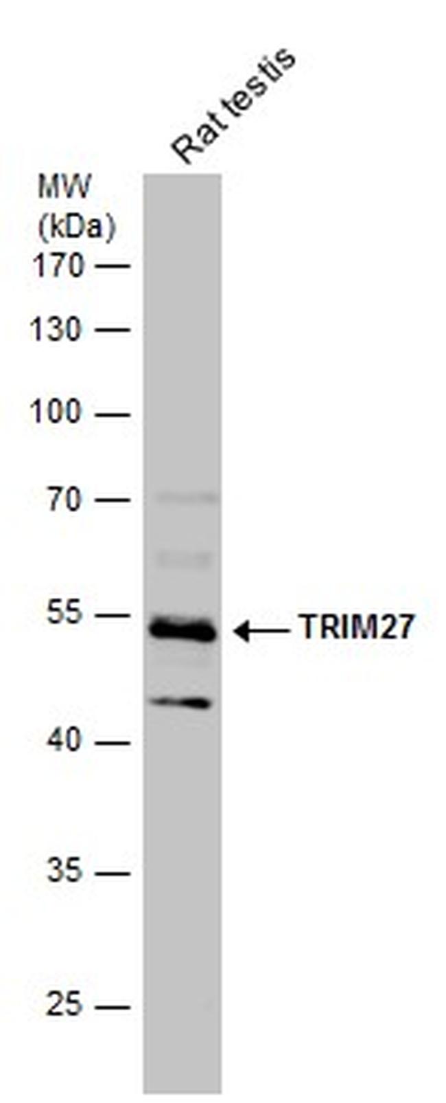 TRIM27 Antibody in Western Blot (WB)