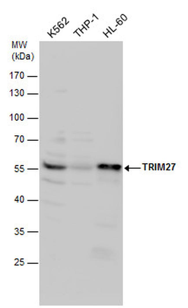 TRIM27 Antibody in Western Blot (WB)