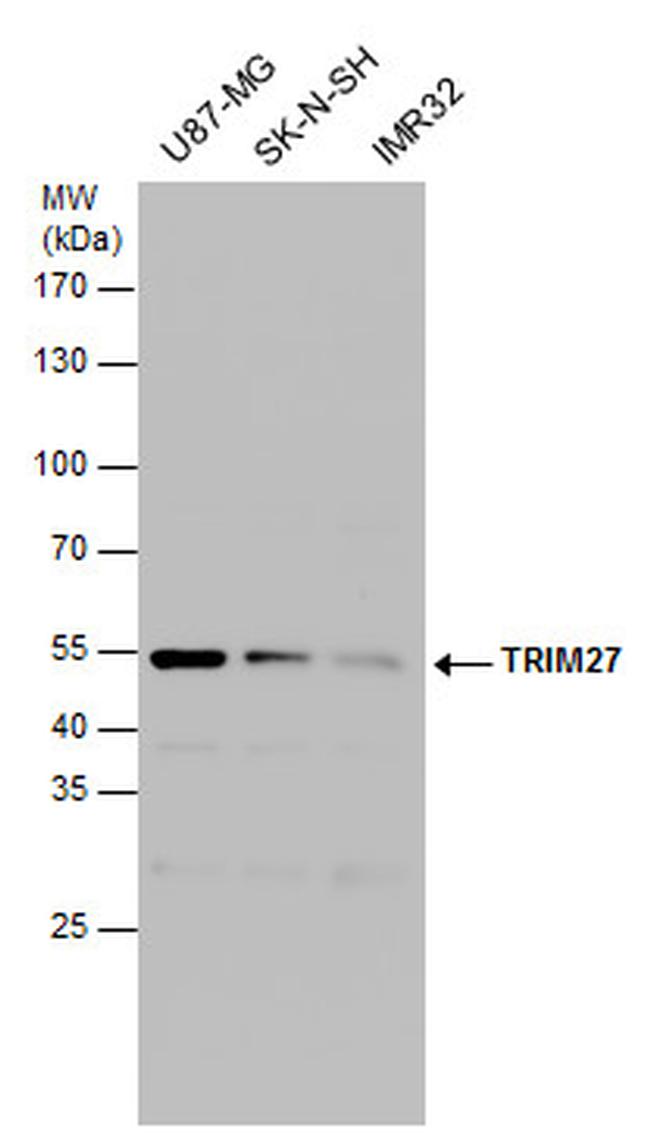 TRIM27 Antibody in Western Blot (WB)