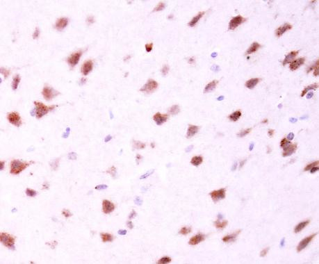 MFN2 Antibody in Immunohistochemistry (Paraffin) (IHC (P))