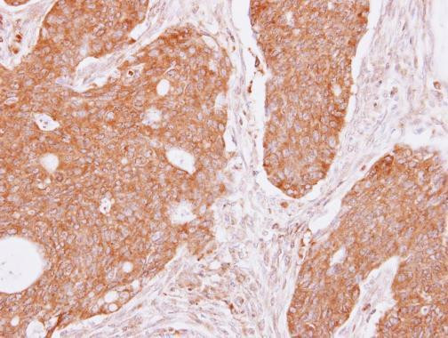 DIAPH1 Antibody in Immunohistochemistry (Paraffin) (IHC (P))