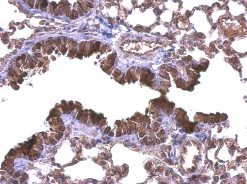 DIAPH1 Antibody in Immunohistochemistry (Paraffin) (IHC (P))