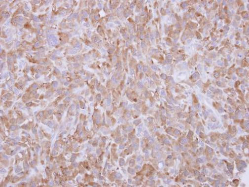 Profilin 1 Antibody in Immunohistochemistry (Paraffin) (IHC (P))