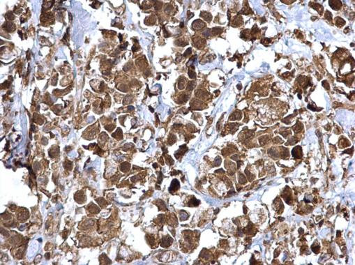 NFkB p65 Antibody in Immunohistochemistry (Paraffin) (IHC (P))