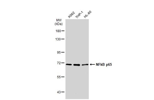 NFkB p65 Antibody in Western Blot (WB)