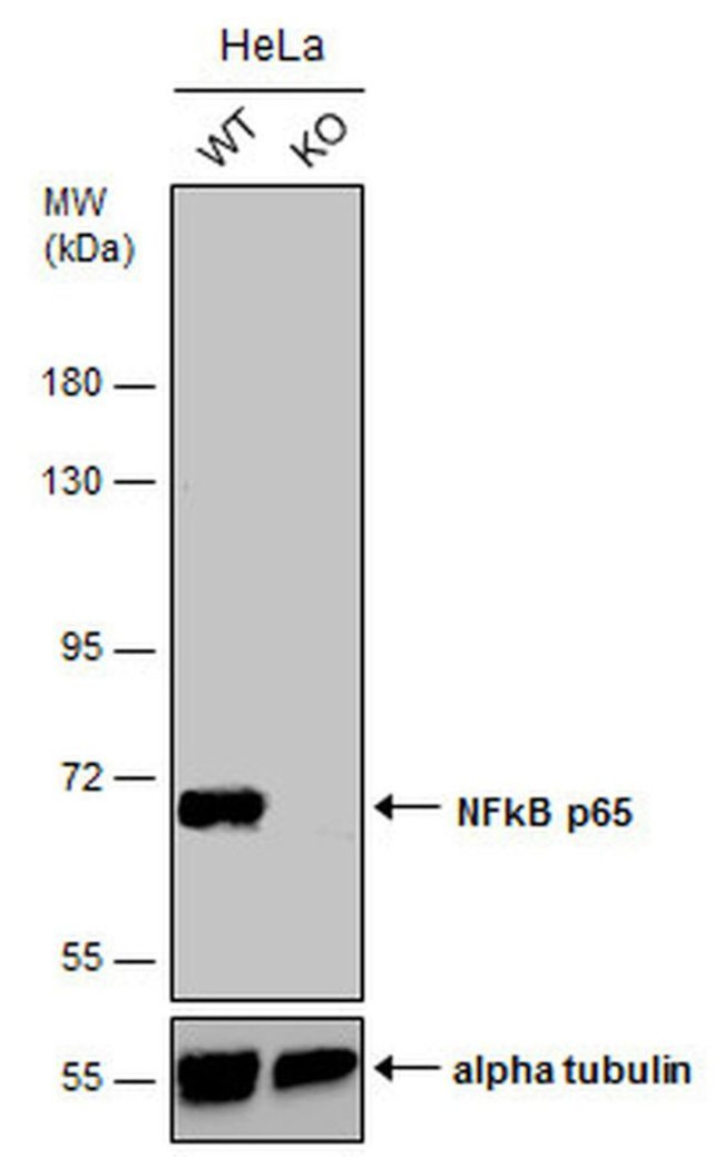 NFkB p65 Antibody