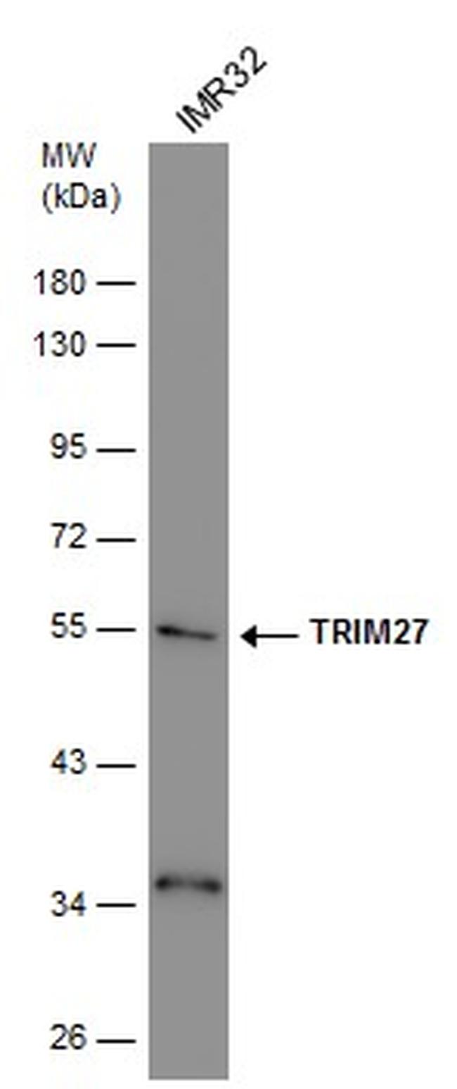 TRIM27 Antibody in Western Blot (WB)