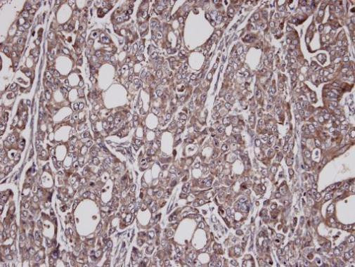 KARS Antibody in Immunohistochemistry (Paraffin) (IHC (P))