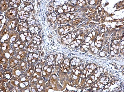 KARS Antibody in Immunohistochemistry (Paraffin) (IHC (P))