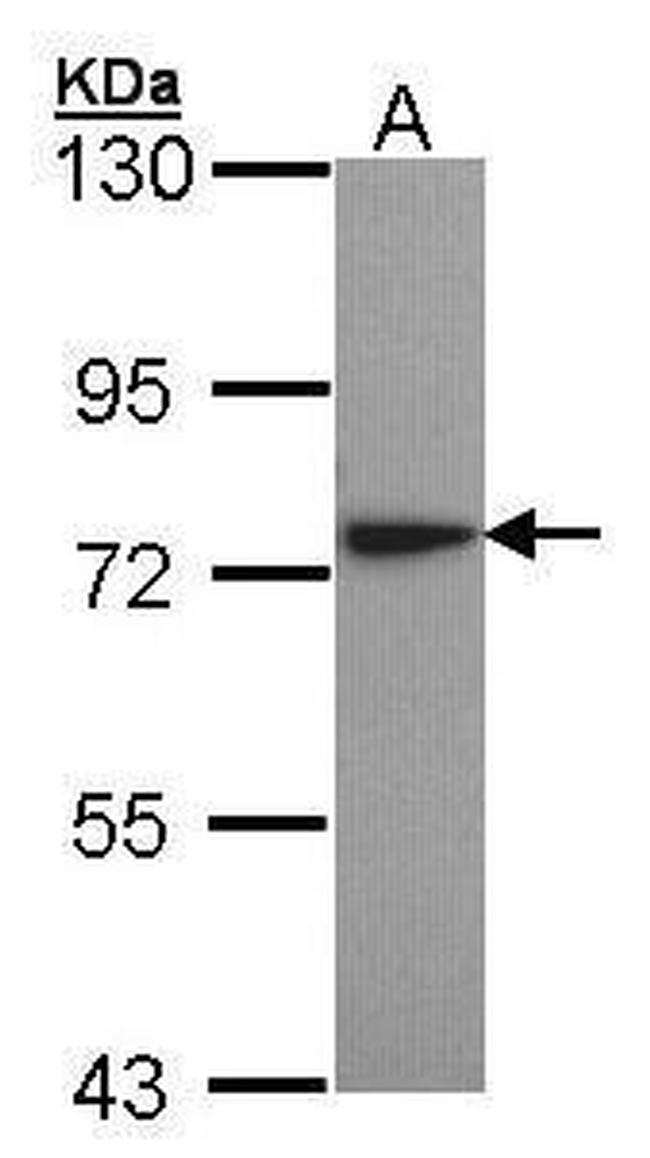 KARS Antibody in Western Blot (WB)