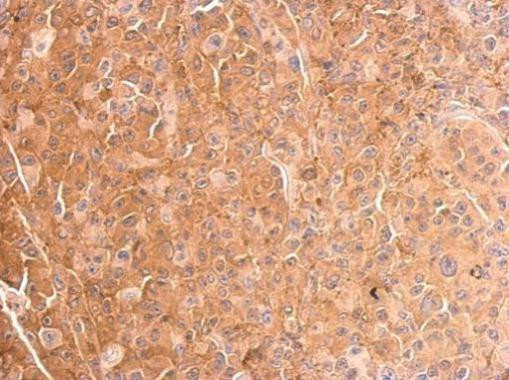 Cofilin Antibody in Immunohistochemistry (Paraffin) (IHC (P))